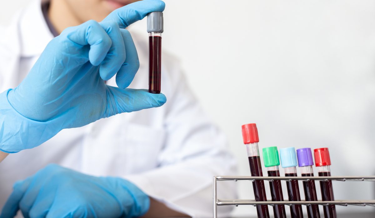 Gloved technician holding a blood sample tube beside a rack of samples