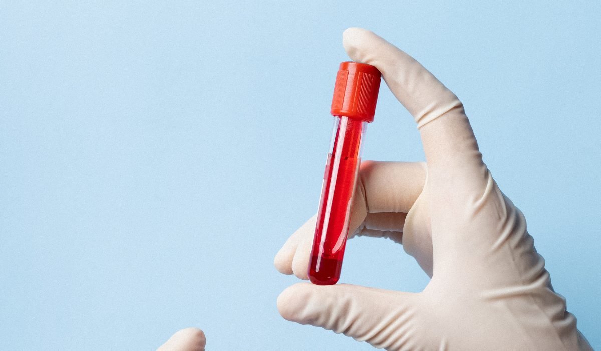 Gloved hand holding a single labelled blood sample tube