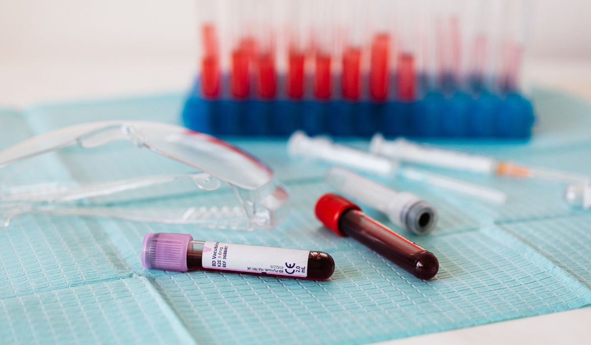 Blood collection tubes and a needle laid out on a sterile tray